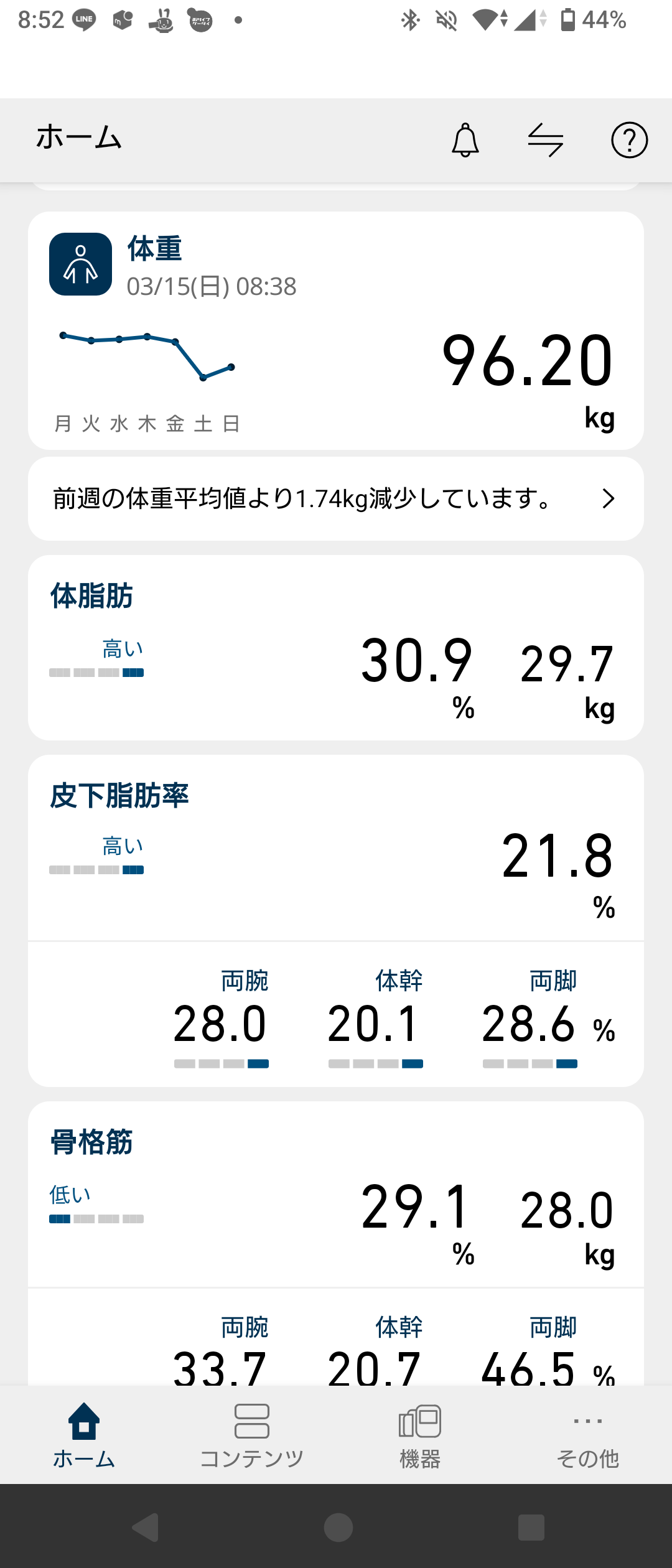 2026年3月15日時点のオムロンアプリの血圧記録。115/86mmHgと不規則脈波検出の表示がある画面